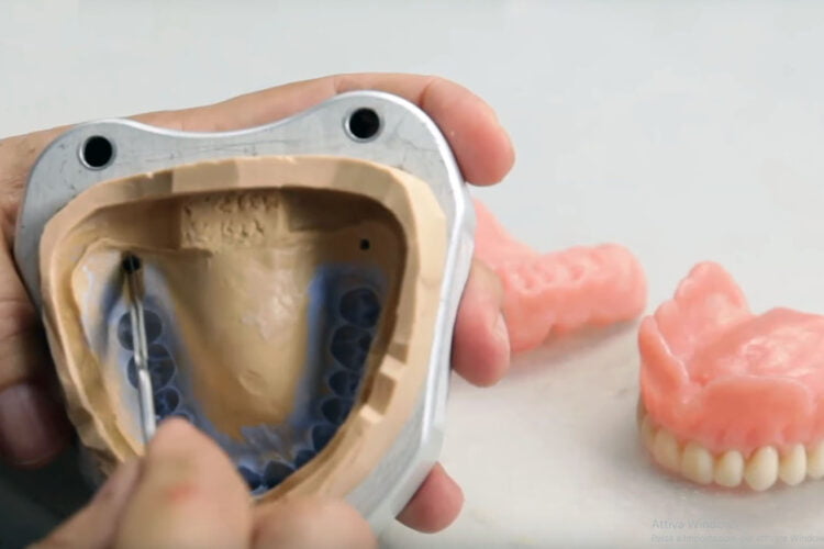 Protesi dentiera 1